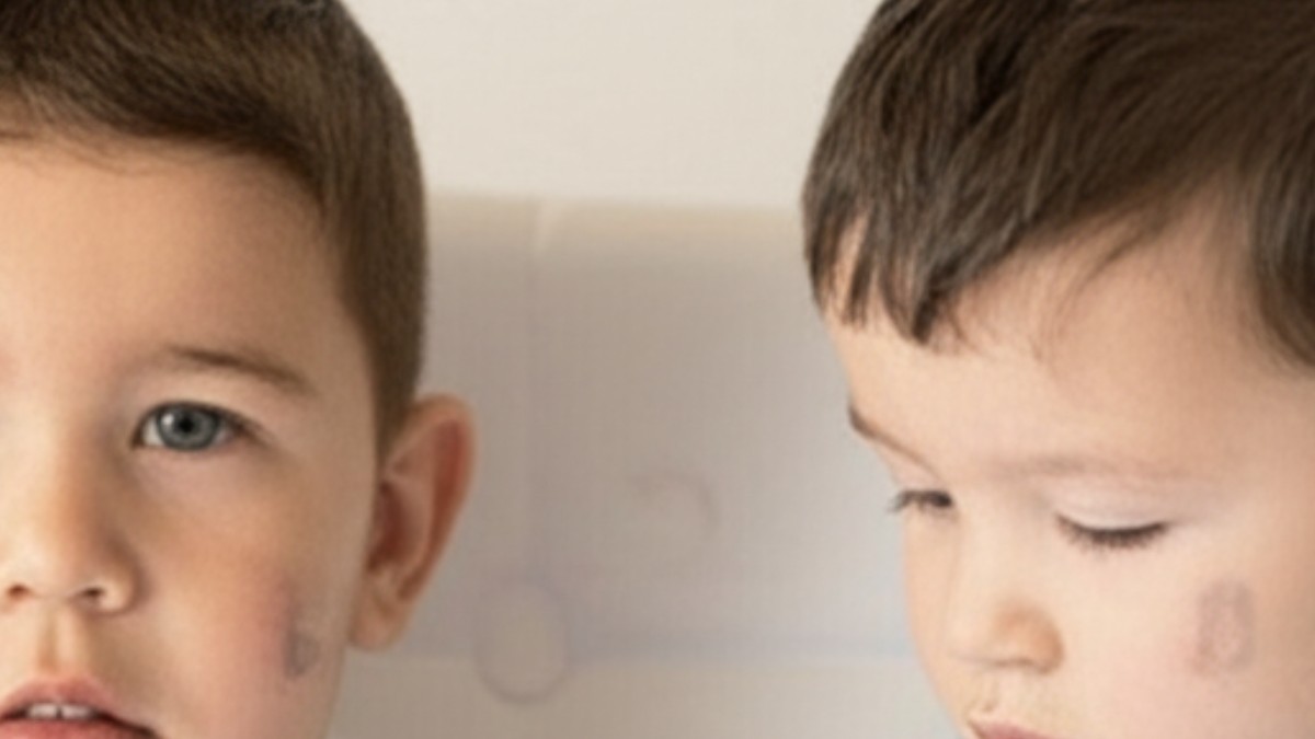 Çocuklarda Sık Görülen Ateş Nedenleri ve Evde Ateş Düşürme Yöntemleri